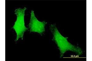 Immunofluorescence of purified MaxPab antibody to PTTG1 on HeLa cell. (PTTG1 抗体  (AA 1-202))