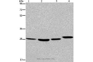 Western blot analysis of 293T and LoVo cell, mouse skin tissue and A172 cell, using ETV7 Polyclonal Antibody at dilution of 1:850 (ETV7 抗体)