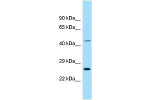 WB Suggested Anti-EIF4E1B Antibody Titration: 1. (EIF4E1B 抗体  (Middle Region))