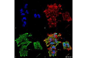 Immunocytochemistry/Immunofluorescence analysis using Mouse Anti-Alpha B Crystallin Monoclonal Antibody, Clone 3A10. (CRYAB 抗体  (HRP))