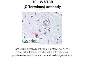 Image no. 1 for anti-Wingless-Type MMTV Integration Site Family, Member 8B (WNT8B) (C-Term) antibody (ABIN1740841)