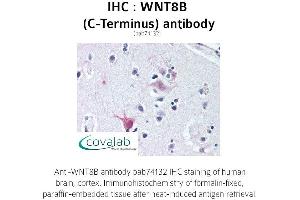 Image no. 1 for anti-Wingless-Type MMTV Integration Site Family, Member 8B (WNT8B) (C-Term) antibody (ABIN1740841) (WNT8B 抗体  (C-Term))