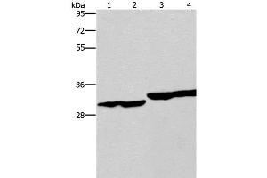 Western Blot analysis of Human endometrial carcinoma and colon cancer tissue, Human fetal liver tissue and PC3 cell using DECR1 Polyclonal Antibody at dilution of 1:300 (DECR1 抗体)
