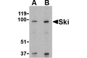 Western Blotting (WB) image for anti-SKI Proto-Oncogene (SKI) (N-Term) antibody (ABIN1031573) (SKI 抗体  (N-Term))
