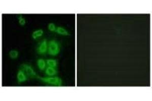 Immunofluorescence analysis of A549 cells, using FXR2 antibody. (FXR2 抗体)
