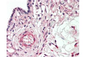 Immunohistochemistry (IHC) image for anti-BTB and CNC Homology 1, Basic Leucine Zipper Transcription Factor 1 (BACH1) (AA 134-421) antibody (ABIN2617424)