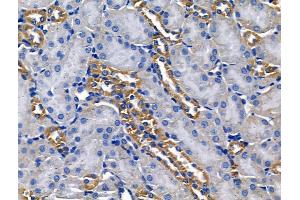 ABIN6260962 and ABIN6268678 at 1/100 staining Mouse brain tissue by IHC-P. (GJB1 抗体  (Internal Region))