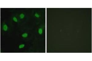 Immunofluorescence analysis of HeLa cells, using TBX15/18 Antibody. (T-Box 15/18 抗体  (AA 161-210))