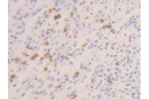 DAB staining on IHC-P; Samples: Human Spleen Tissue (Caspase 1 抗体  (AA 120-297))