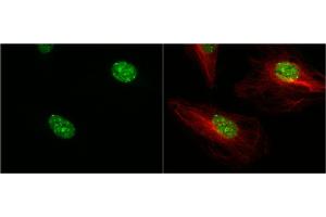 ICC/IF Image 53BP1 antibody [N1], N-term detects 53BP1 protein at nucleus by immunofluorescent analysis. (TP53BP1 抗体  (N-Term))