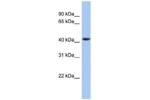 STOML3 antibody used at 1 ug/ml to detect target protein. (STOML3 抗体)