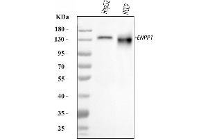 Western blot analysis of ENPP1/PC1 using anti-ENPP1/PC1 antibody (ABIN7601410).