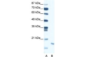 WB Suggested Anti-DIABLO Antibody Titration:  0. (DIABLO 抗体  (C-Term))