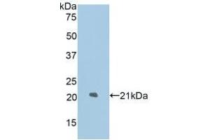 Detection of Recombinant LAMP2, Rat using Polyclonal Antibody to Lysosomal Associated Membrane Protein 2 (LAMP2) (LAMP2 抗体  (AA 191-362))