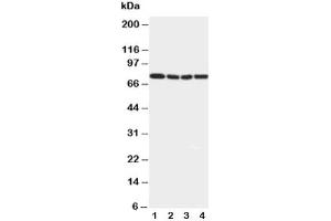 Western blot testing of IRAK1 antibody and Lane 1:  rat liver (IRAK1 抗体  (N-Term))