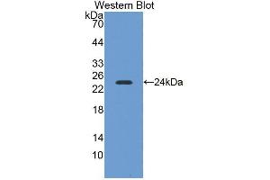 Western blot analysis of the recombinant protein. (NEIL3 抗体  (AA 2-187))