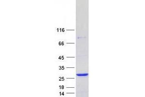 Western Blotting (WB) image for RAB22A, Member RAS Oncogene Family (RAB22A) protein (Myc-DYKDDDDK Tag) (ABIN2730298)