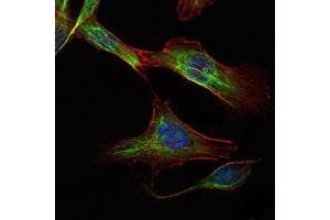 Immunofluorescence analysis of NIH/3T3 cells using RICTOR mouse mAb (green). (RICTOR 抗体)