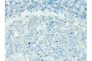 Immunohistochemistry of paraffin-embedded human vermiform appendix using CD19 antibody (ABIN5971402) at dilution of 1/100 (40x lens). (CD19 抗体)