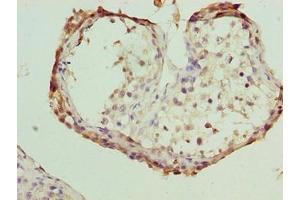 Immunohistochemistry of paraffin-embedded human testis tissue using ABIN7152907 at dilution of 1:100 (FSIP1 抗体  (AA 101-400))