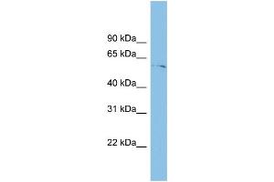 WB Suggested Anti-TINAGL1 Antibody Titration: 0. (TINAGL1 抗体  (Middle Region))