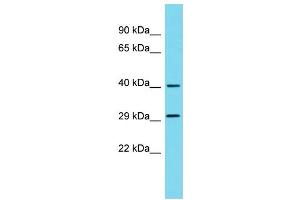 Host: Rabbit Target Name: METAP1D Sample Type: 293T Whole Cell lysates Antibody Dilution: 1. (MAP1D 抗体  (N-Term))