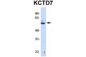 Host:  Rabbit  Target Name:  KCTD7  Sample Type:  Human Fetal Lung  Antibody Dilution:  1. (KCTD7 抗体  (N-Term))