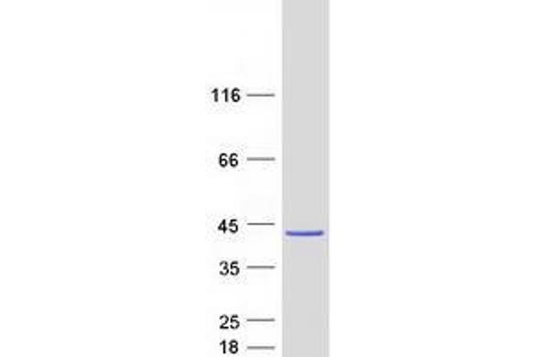 CCDC50 Protein (Transcript Variant 1) (Myc-DYKDDDDK Tag)