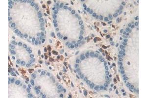 Detection of TNFa in Human Stomach Tissue using Polyclonal Antibody to Tumor Necrosis Factor Alpha (TNFa)
