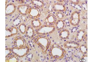 Formalin-fixed and paraffin embedded human kidney labeled with Rabbit Anti-AQP9 Polyclonal Antibody, Unconjugated  at 1:200 followed by conjugation to the secondary antibody and DAB staining (AQP9 抗体  (AA 201-295))