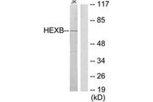 Western Blotting (WB) image for anti-Hexosaminidase B (Beta Polypeptide) (HEXB) (AA 481-530) antibody (ABIN2879138) (HEXB 抗体  (AA 481-530))