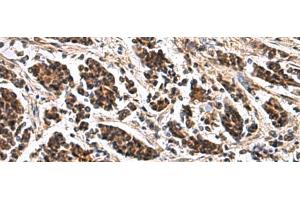 Immunohistochemistry (Paraffin-embedded Sections) (IHC (p)) image for anti-Actin Related Protein 2/3 Complex, Subunit 1B, 41kDa (ARPC1B) antibody (ABIN7247828)