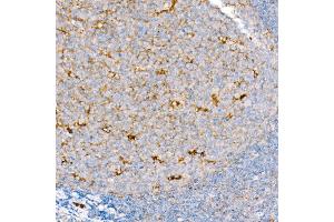 Immunohistochemistry of paraffin-embedded Human tonsil using CD63 antibody (ABIN7266210) at dilution of 1:200 (40x lens). (CD63 抗体)