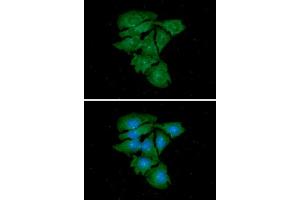 ICC/IF analysis of TUBG1 in HeLa cells. (TUBG1 抗体  (AA 1-451))