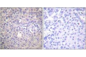 Immunohistochemistry (IHC) image for anti-Insulin Receptor Substrate 1 (IRS1) (AA 578-627), (pSer616) antibody (ABIN1531291)