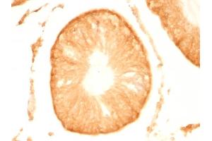 Formalin-fixed, paraffin-embedded Rat Testis stained with Pgp9. (UCHL1 抗体)