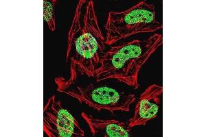 Immunofluorescence (IF) image for anti-Kruppel-Like Factor 6 (KLF6) antibody (ABIN3002701) (KLF6 抗体)