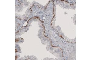 Immunohistochemical staining (Formalin-fixed paraffin-embedded sections) of human prostate with LAMB3 monoclonal antibody, clone CL3353  shows immunoreactivity in basement membrane of glandular epithelium. (Laminin beta 3 抗体)