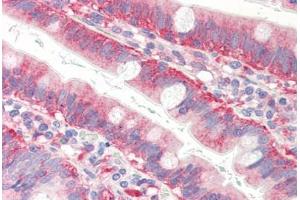 anti-Cofilin 1 (CFL1) (AA 1-166) antibody