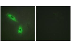 Immunofluorescence analysis of HeLa cells, using TNFC antibody. (LTB 抗体  (C-Term))