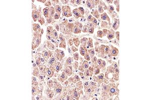 Immunohistochemical analysis of paraffin-embedded H. (ALDH6A1 抗体)