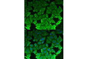 Immunofluorescence analysis of MCF-7 cells using EEF2K antibody (ABIN5973133).