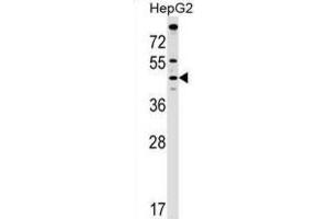 Western Blotting (WB) image for anti-Malonyl CoA:ACP Acyltransferase (Mitochondrial) (MCAT) antibody (ABIN2999330)