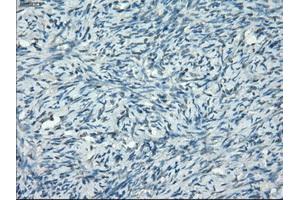 Immunohistochemical staining of paraffin-embedded colon tissue using anti-PPP5Cmouse monoclonal antibody. (PP5 抗体)