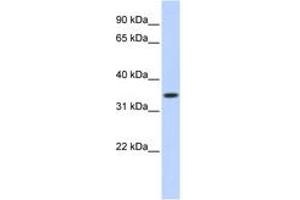 Image no. 1 for anti-Tripartite Motif Containing 27 (TRIM27) (AA 141-190) antibody (ABIN6744473) (TRIM27 抗体  (AA 141-190))