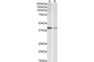 ABIN2613399 (0. (Cardiac Troponin T2 抗体  (AA 201-213))