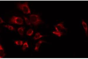 ABIN6277353 staining NIH-3T3 by IF/ICC. (CXCR2 抗体  (C-Term))