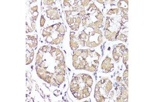 Immunohistochemistry (Paraffin-embedded Sections) (IHC (p)) image for anti-Opioid Receptor, kappa 1 (OPRK1) (C-Term) antibody (ABIN6145043)