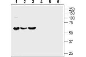 Western blot analysis of mouse brain (lanes 1 and 4), rat brain (lanes 2 and 5) and rat cerebellum (lanes 3 and 6) lysates: - 1-3. (ADCYAP1R1 抗体  (C-Term, Intracellular))