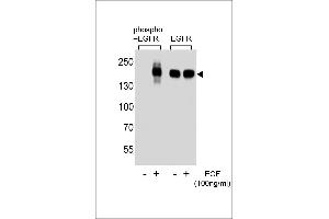 Western blot analysis of extracts from A431 cell, untreated or treated with EGF, using phospho-EGFR-p (left) or ErBB2 antibody (right). (EGFR 抗体  (pSer1070))